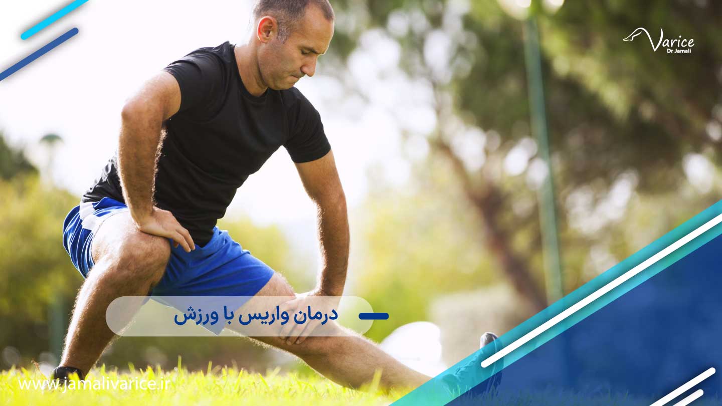 درمان واریس با ورزش